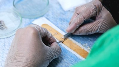 Nutrition pour maladies chroniques : 86% des besoins sont liés à